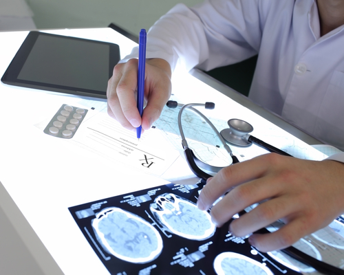Closeup of a doctor outlining the effects of epilepsy after studying brain scans on a desk