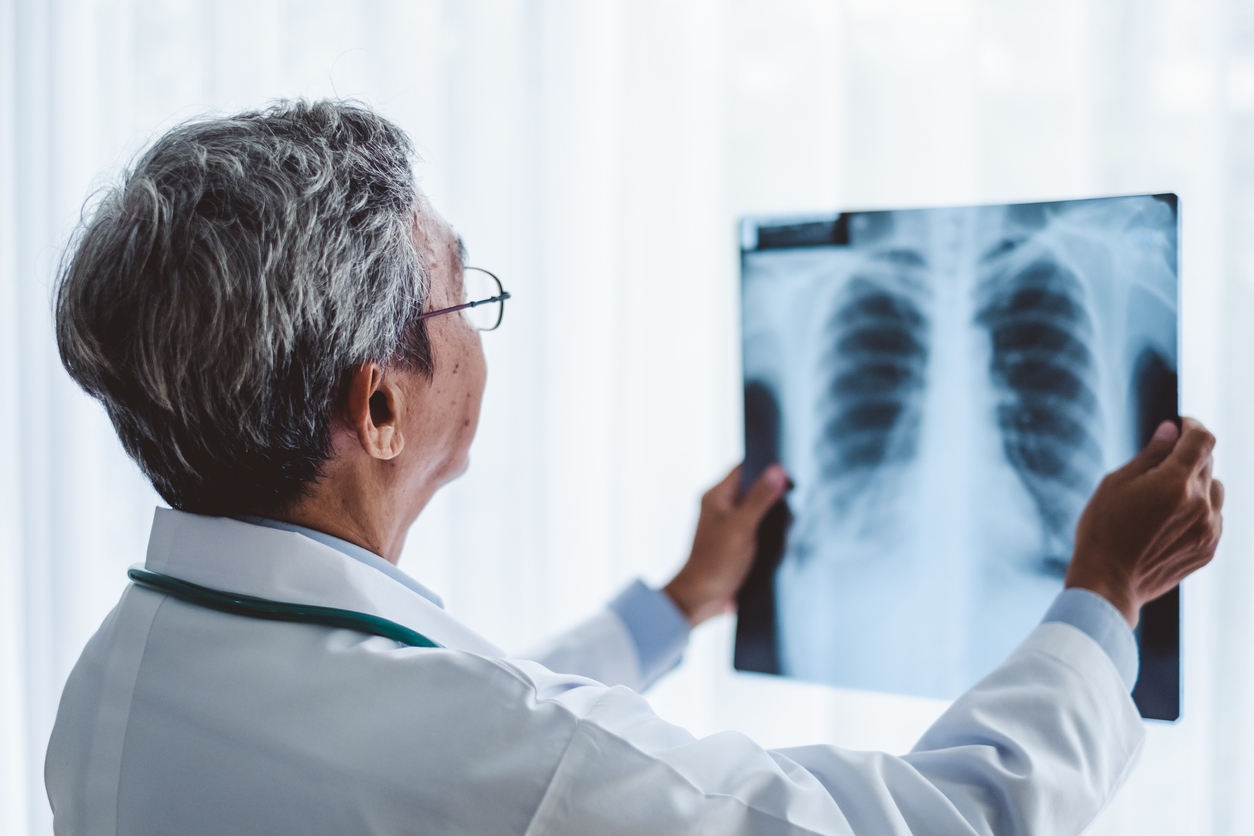 Diagram of lungs used by thoracic surgeons in New Jersey