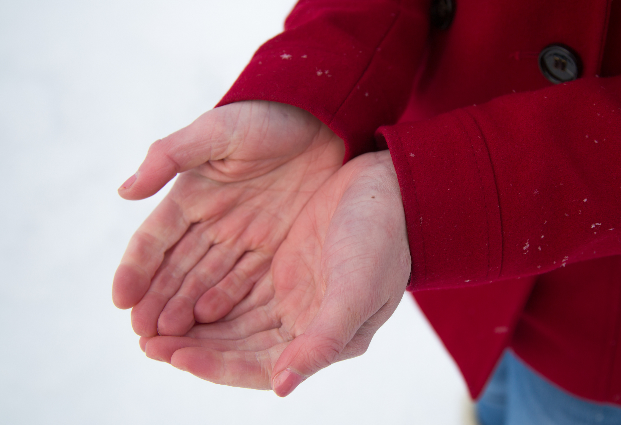 Raynaud's Phenomenon turning a person's hands different colors in the cold