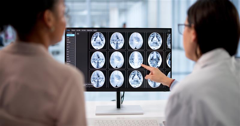 Physicians looking at brain imaging scans for patients. 
