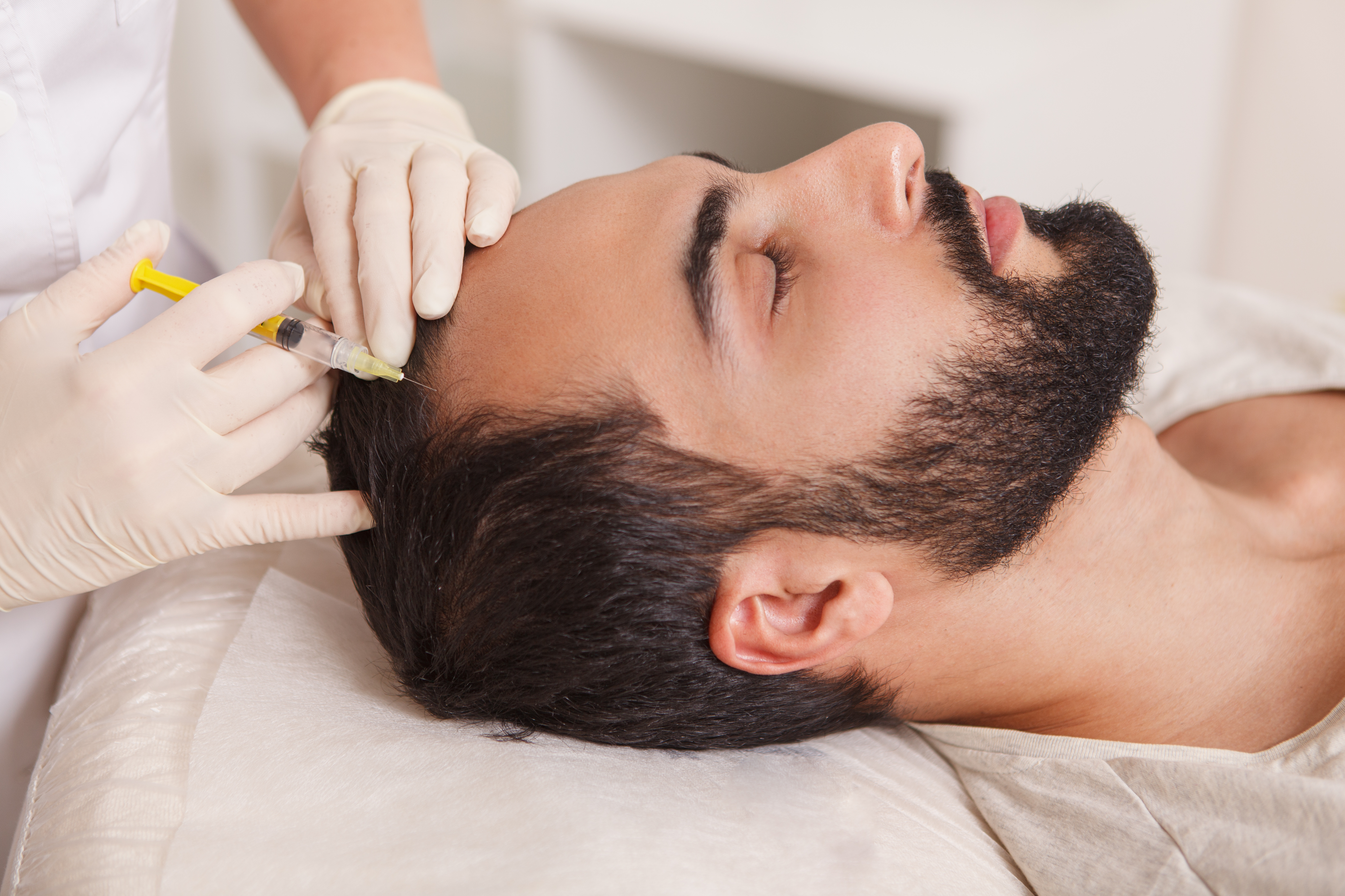 Male patient receiving Platelet-Rich Plasma (PRP) treatments for hair restoration