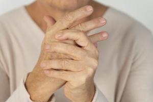 Closeup of a person's hands experiencing autoimmune skin disease symptoms