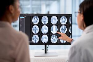 Physicians looking at brain imaging scans for patients. 