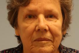 Upper Blepharoplasty and Brow Lift